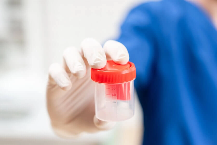 ETG alcohol test by reading a magazine